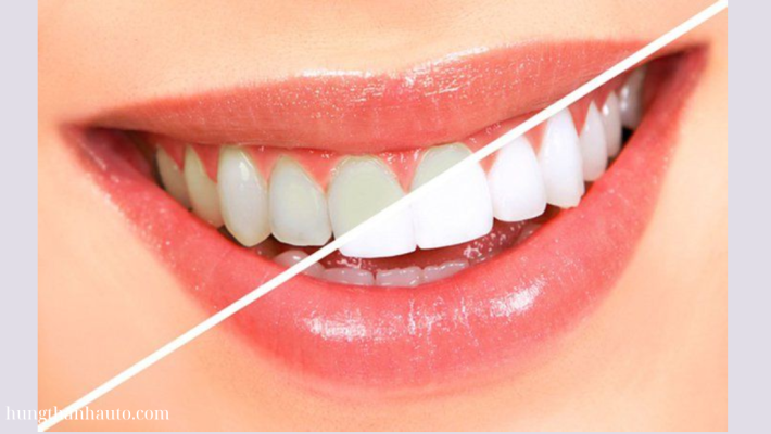 Affordable whitening toothpaste